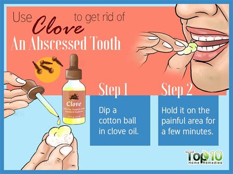 Home Remedies for an Abscessed Tooth | Top 10 Home Remedies