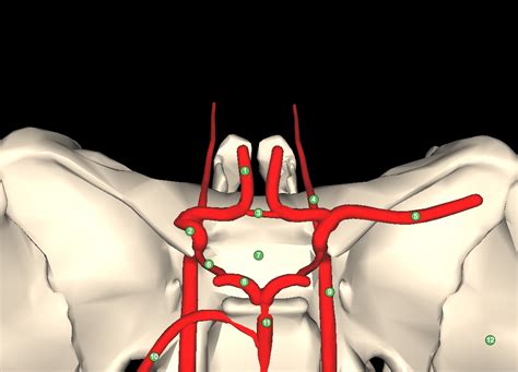 Anterior communicating artery | Osmosis