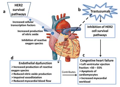 Endothelial Dysfunction as a Determinant of Trastuzumab-mediated ...