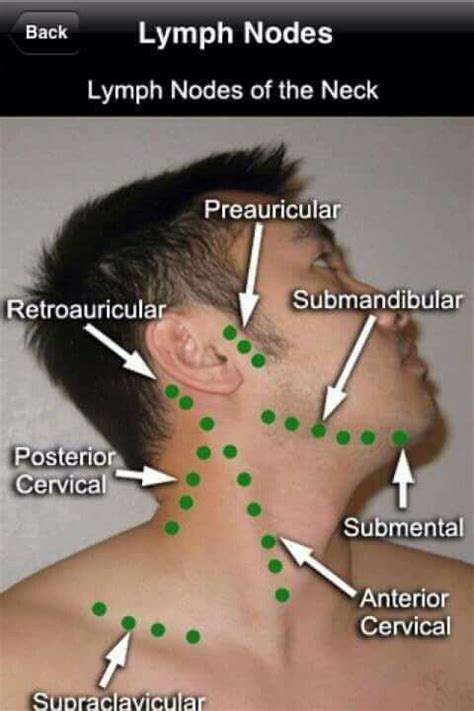 Lymph Nodes of the neck | Medical knowledge, Medical education, Medical