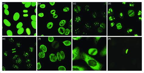 ANA immunofluorescence patterns recognized by the EUROPattern Suite ...