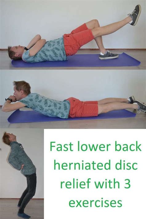 Herniated disc treatment L5-S1 with 3 exercises to avoid surgery