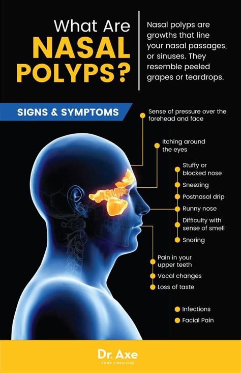 13 Signs You've Got a Nasal Polyp Problems (And How to Fix It ...