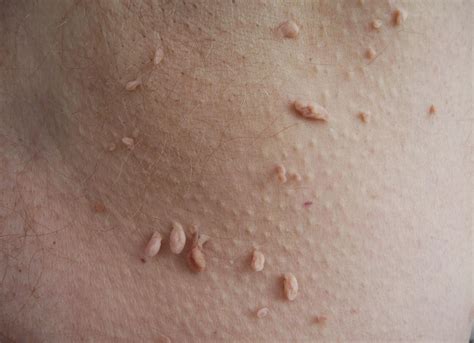 MedFriendly Medical Blog: Beyond 40: Common Skin Problems & Treatment ...