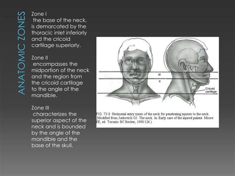 PPT - Neck Trauma PowerPoint Presentation, free download - ID:4606897