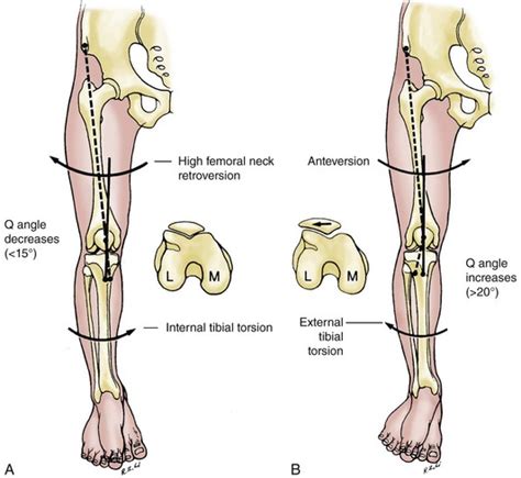 Clinical Examination of the Knee | Musculoskeletal Key