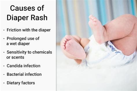 How to Treat Diaper Rash & 4 Tips to Prevent It