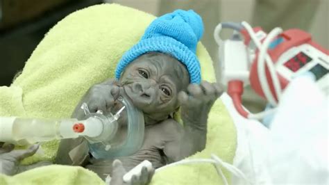 Baby Gorilla Born By Rare C-Section at San Diego Zoo Safari Park - YouTube