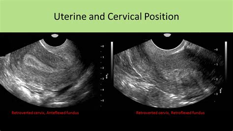 Ultrasound Registry Review - General Information - DaftSex HD