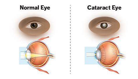 Mackey Vision Center - Optical, Medical & Surgical Eye Care in Corbin, KY