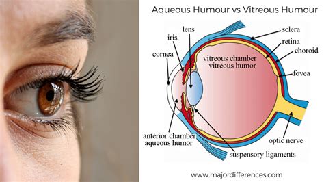 Difference between Aqueous Humour and Vitreous Humour (Aqueous Humour ...