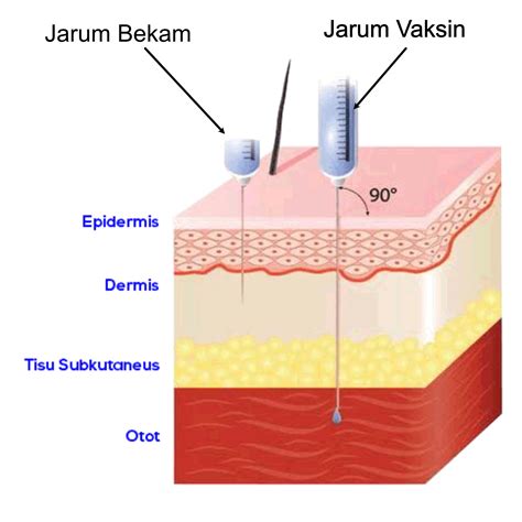 Darah Bekam Selepas Vaksin - www.suhazeli.com/wp