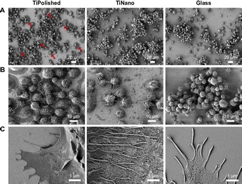 Field-emission scanning electron microscopy of U937 macrophages on ...