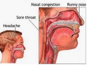 Mucus Stuck In Throat - Causes, Treatment, Prevention