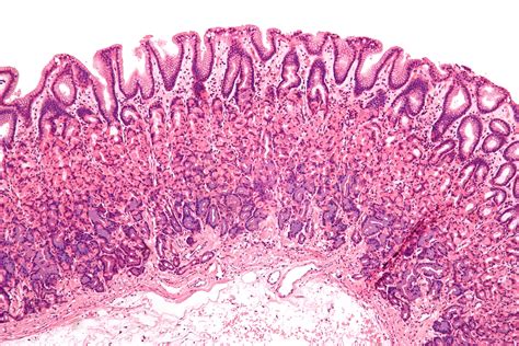 Histology - Stomach - Gastric Portion H&e Stain, Histology Slides ...