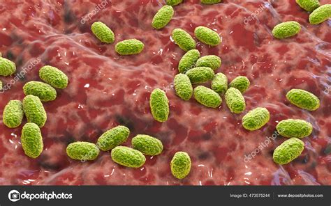 Whooping Cough Bacteria Bordetella Pertussis Illustration Gram Negative ...