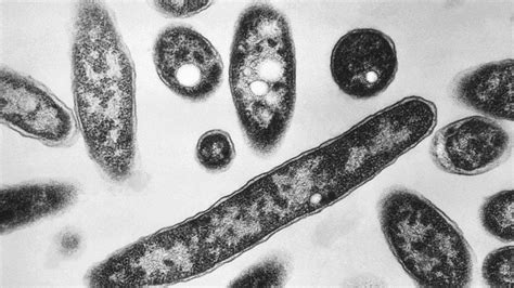 Legionnaires' disease has killed 16 people in Poland and been found on ...