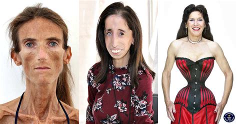 Thinnest woman in the world - 3 impressive stories - Legit.ng