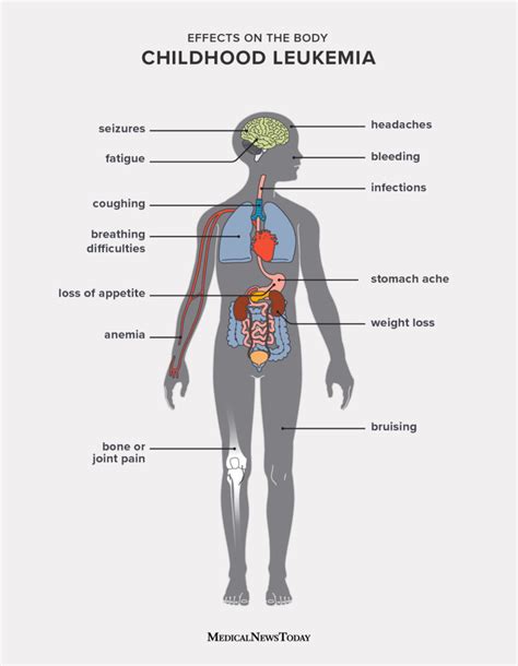 Leukemia Children Symptoms