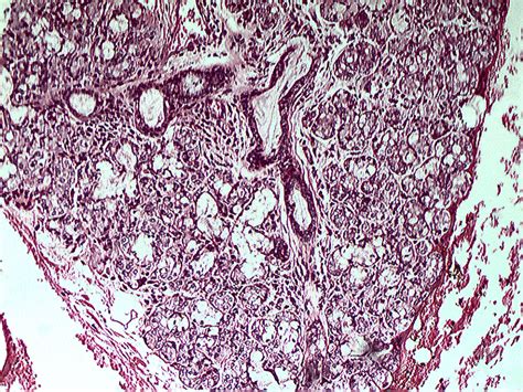 Human Sublingual Gland | Histology