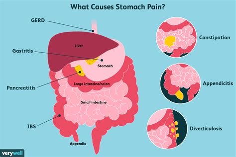 Where Is Gastric Pain Located