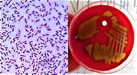 MORPHOLOGY AND CULTURE CHARACTERISTICS OF STREPTOCOCCUS PNEUMONIAE ...