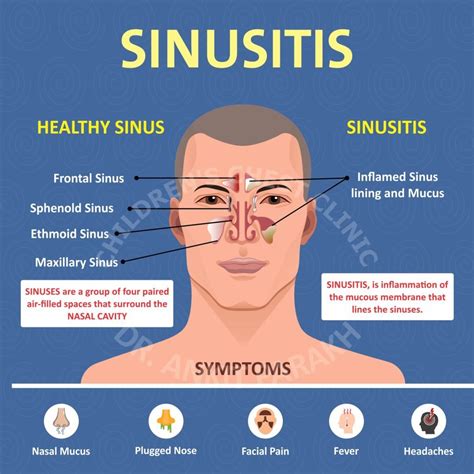 Sinusitis in Children - Dr. Ankit Parakh