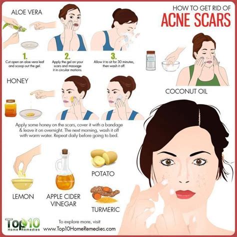 Pin on How to Get Rid of Painful Acne Scars Fast