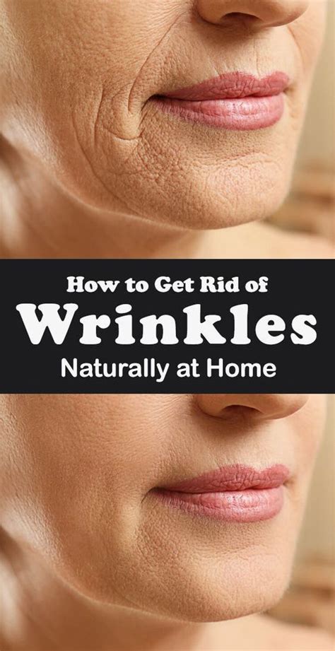 Home Remedies To Get Rid Of Wrinkles On The Face Naturally - Healthy ...