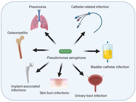 How To Prevent Pseudomonas Aeruginosa - Proofcheek Spmsoalan