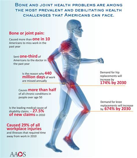 Joint Pain And Muscle Weakness at Casey Batson blog