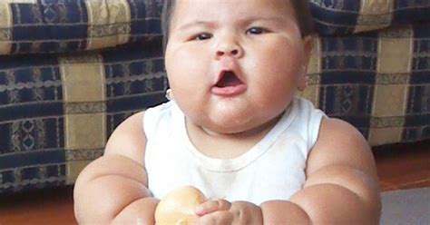 Obese Baby With Mystery Illness Weighs 20Kgs At Just 10 Months Old