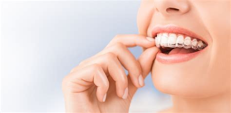 Clear Correct vs. Invisalign - Adsorthodontics