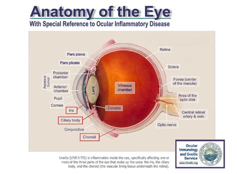 Uveitis Diagram