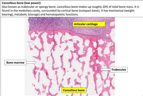 Bone – Normal Histology – NUS Pathweb :: NUS Pathweb