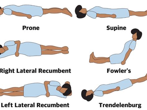 lateral recumbent position - Google Search | Radiology student ...