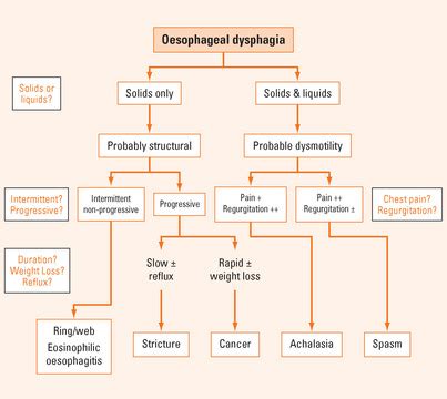 Dysphagia and odynophagia | Clinical Gate