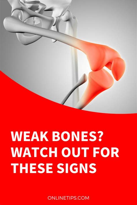 Weak Bones? Watch Out for These Signs | Weak bones, Weak, Bone density