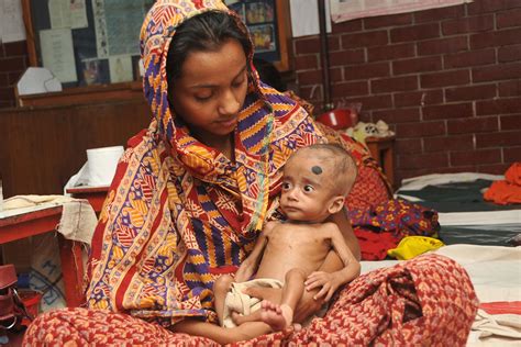 For malnourished children, new therapeutic food boosts gut microbes ...