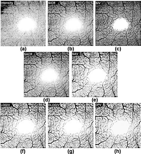 Parafoveal depth-integrated en face views over 4 mm2 FOV acquired in 4 ...