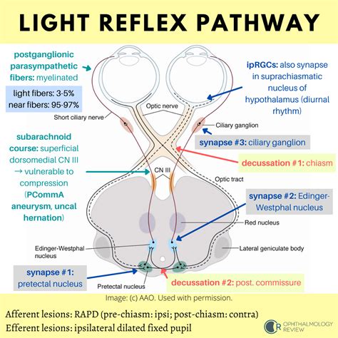 The Light Reflex Pathway — Ophthalmology Review