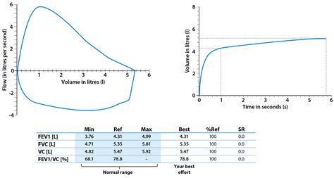 Spirometry test, spirometry results & spirometry interpretation