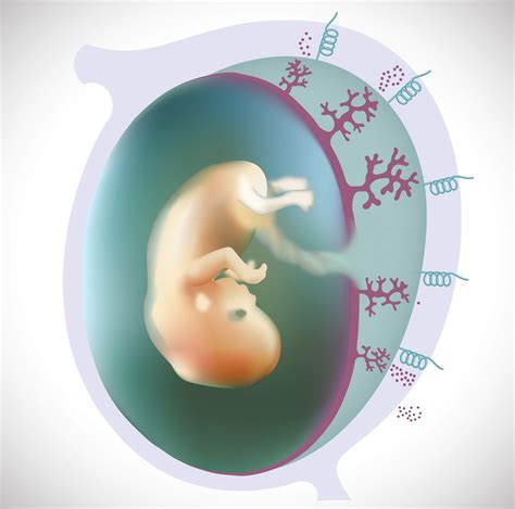 Recurrent miscarriage