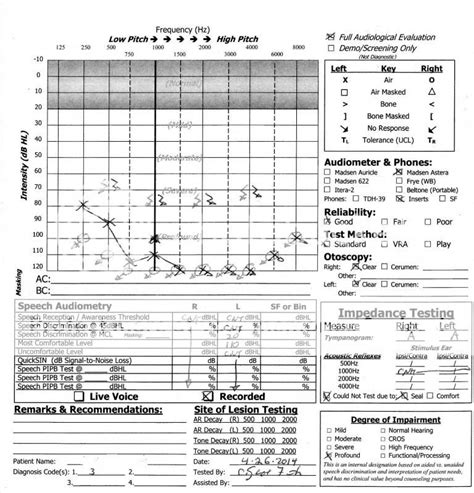 Posting audiogram results - Question and Answer - Hearing Aid Forum ...