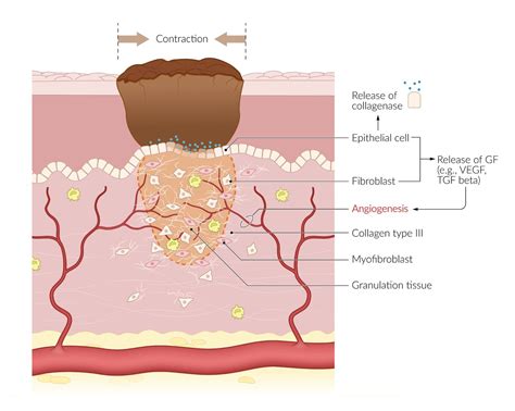 What Stage Of Healing Does Granulation Tissue Signify?