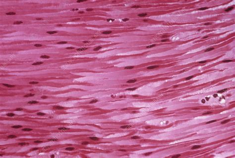 LM of a section through human smooth muscle tissue - Stock Image - P154 ...