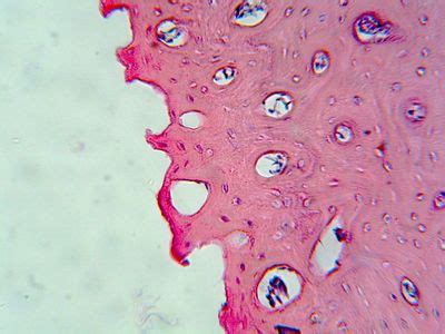 Bone Histology - Spongy bone - histology slide