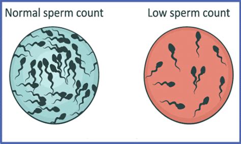 Diet Chart for Oligospermia - Foods to Consume and Avoid in Oligospermia