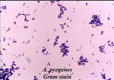 Gram Negative Coccobacillus