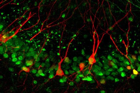 Study reveals molecular mechanisms of memory formation | Brain and ...